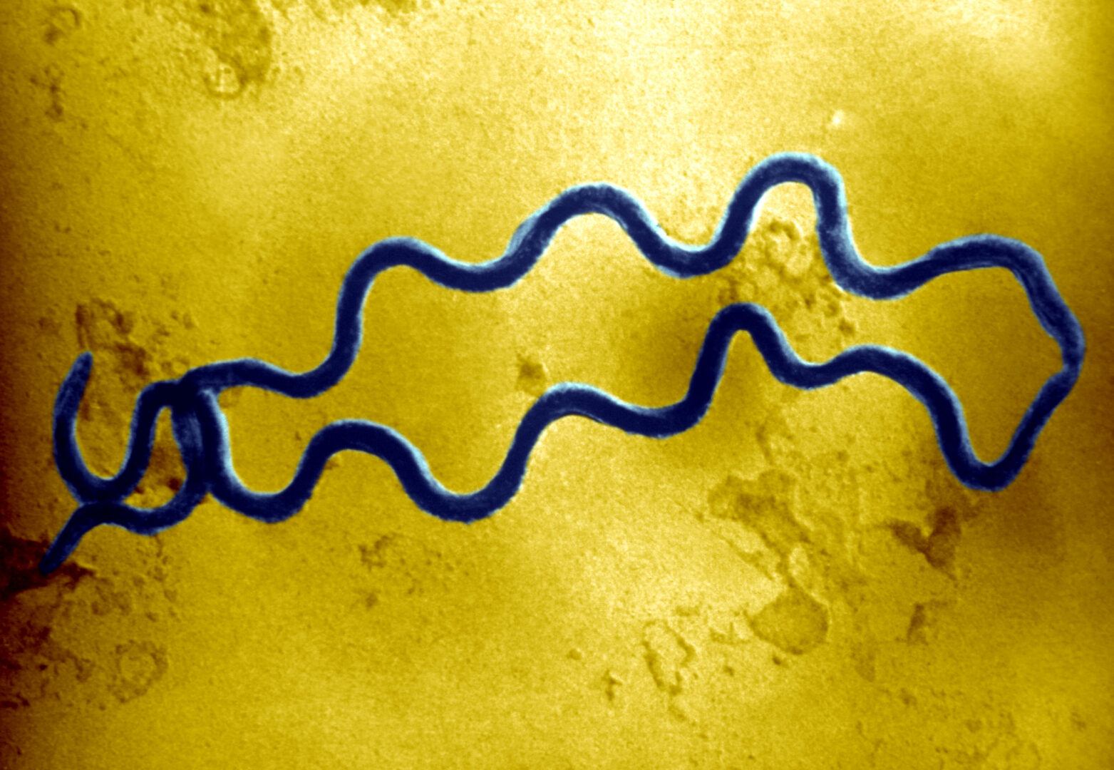 An electron photomicrograph of two spiral-shaped Treponema pallidum bacteria. T. pallidum Is the causative agent of syphilis.