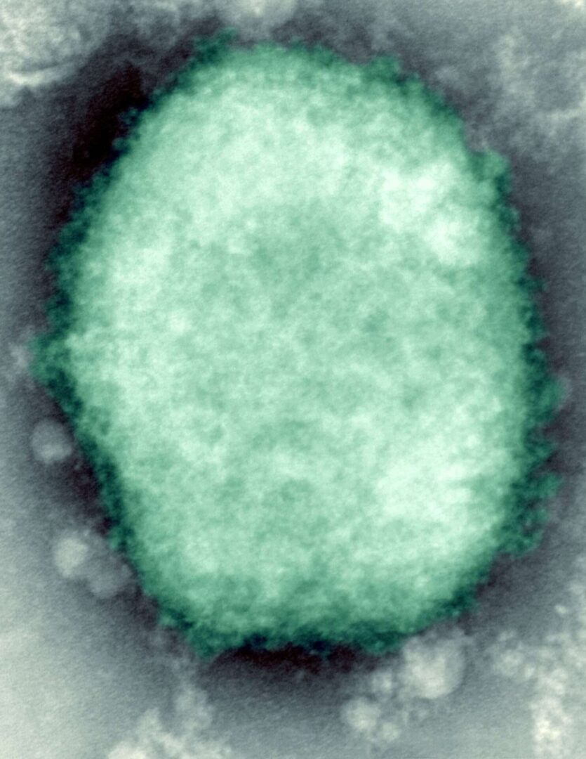 Monkeypox virus. 